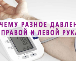 Почему давление разное на правой и левой руке? Какому давлению верить? Сильно большая разница давления на разных руках: что делать, как это влияет на здоровье?