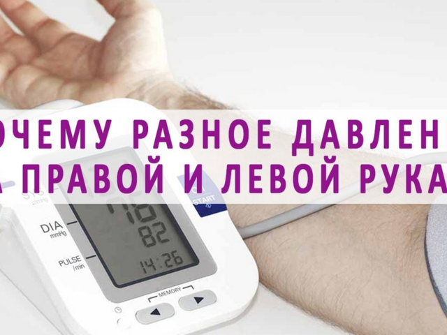 Почему давление разное на правой и левой руке? Какому давлению верить? Сильно большая разница давления на разных руках: что делать, как это влияет на здоровье?