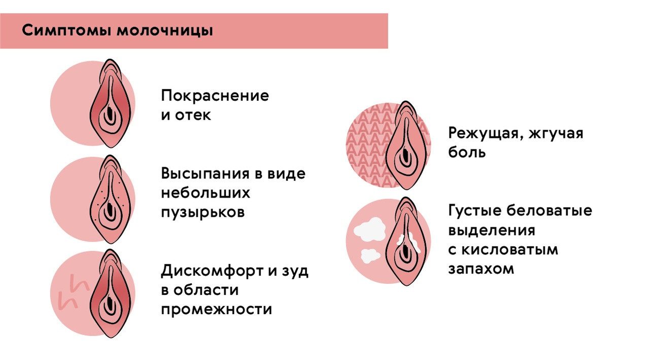 Нашли симптомы молочницы - обследуйтесь и начните облегчать состояние хлоргексидином