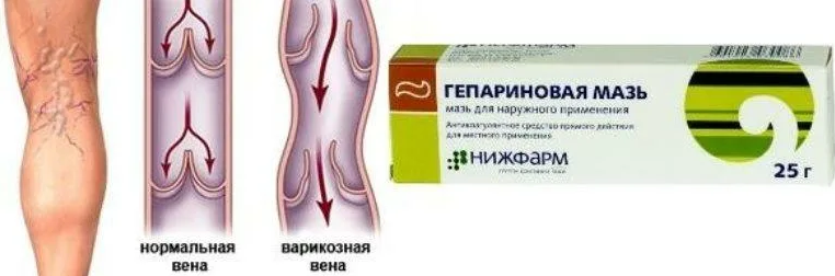 Гепариновая мазь
