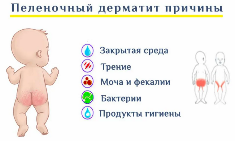 Причины раздражения