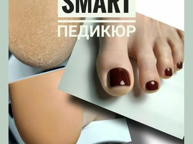 Чем отличается смарт-педикюр от обычного педикюра: какие используются инструменты, преимущества и недостатки