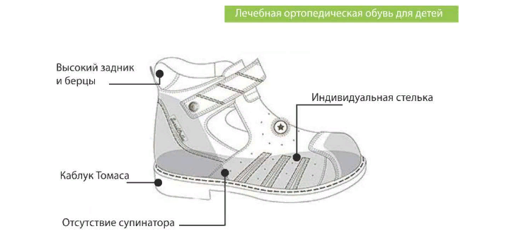 Ортопедическая обувь