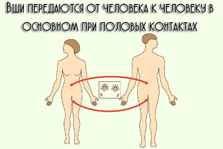 Лобковый педикулез — причина прыщей на лобке