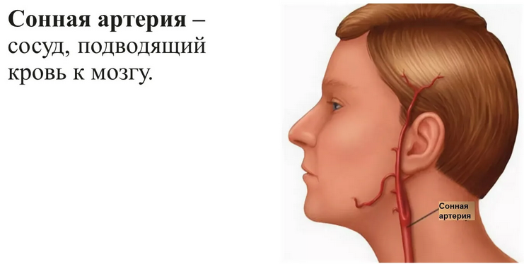 Сонная артерия