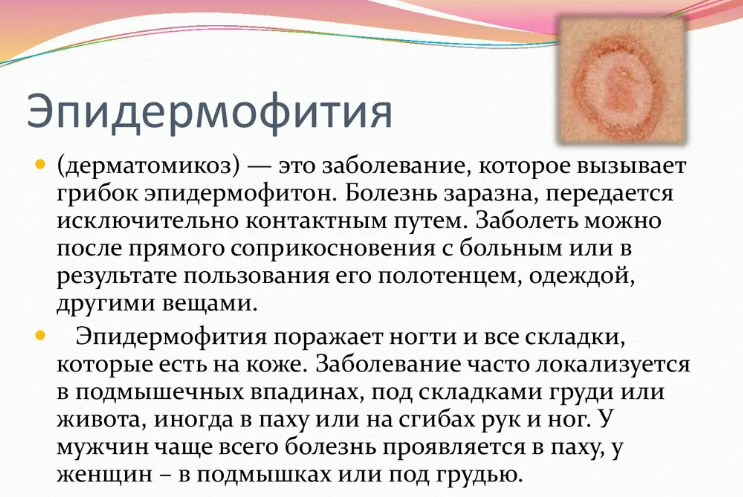 Паховая эпидермофития — покраснение между ног