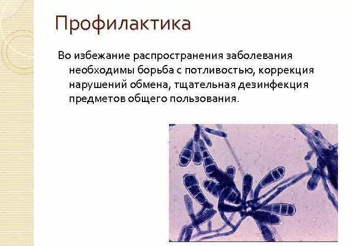 Профилактика покраснения между ног