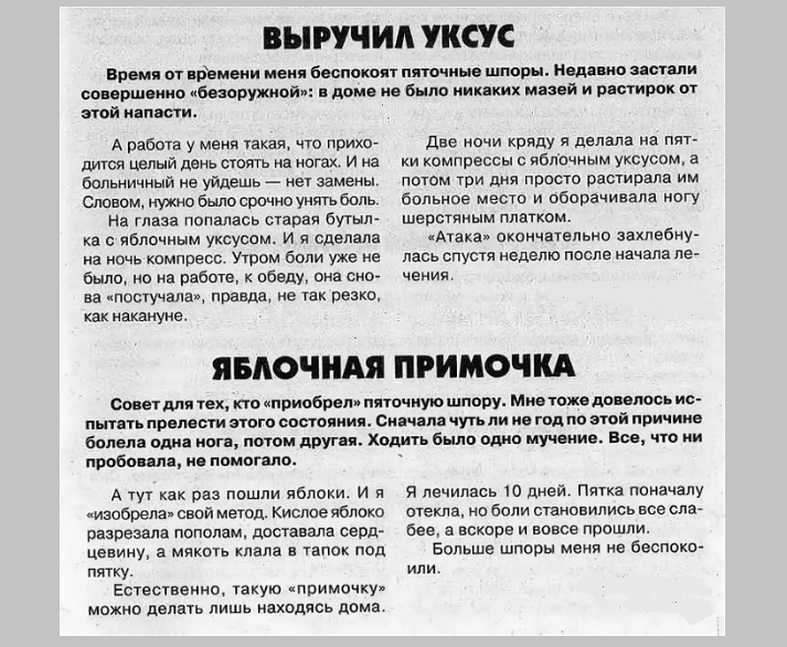 Лечение пяточной шпоры