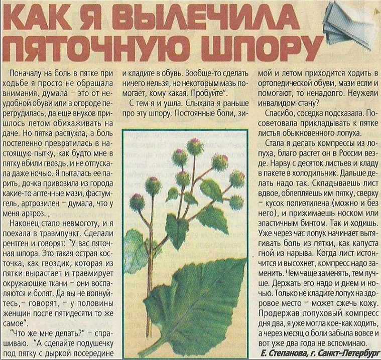 Рецепт лечения пяточной шпоры