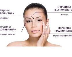 Что означают вертикальные морщины между бровями у мужчины и женщины: народные приметы. Одна и две глубокие морщины между бровями: что означают в физиогномике?
