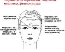 Морщины на переносице у женщин и мужчин: народные приметы, что означают в физиогномике?