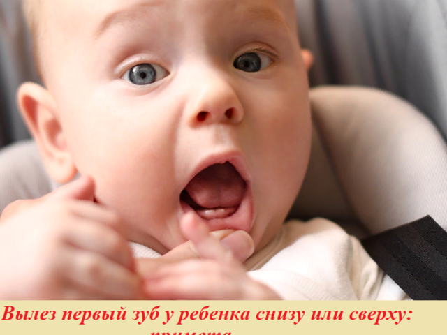 Вылез первый зуб у ребенка снизу или сверху: примета. Кто первый увидел зуб у младенца: примета