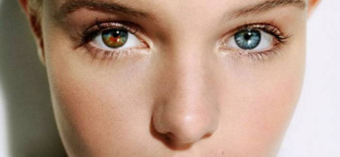 Глаза разного цвета