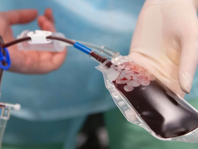 Можно ли мусульманам в Исламе делать переливание крови? Почему переливание крови считалось грехом в Исламе?