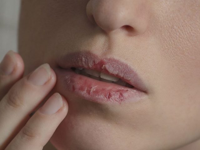 К чему сохнут губы, жжет губы у девушки, женщины, мужчины приметы по дням недели