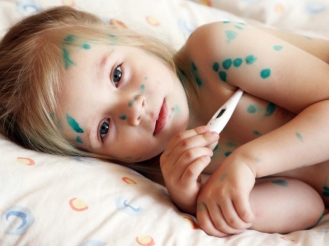 Is it possible to walk a child who is ill chickenpox: on what day can you walk with chickenpox?