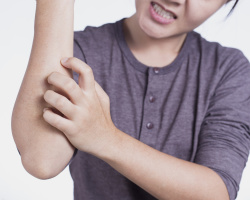 Black, red, white spots on the elbows in adults and children: causes, methods of treatment with folk methods and pharmacy, reviews