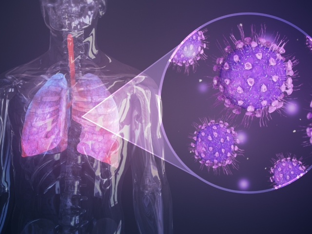 Lunginflammation och inflammation i lungorna: en och samma eller inte, vad är skillnaden, tecken. Vad är skillnaden mellan lunginflammation från coronavirus lunginflammation?