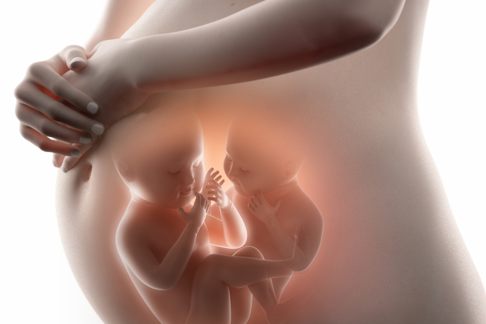 Тазовое предлежание и многоплодная беременность - показания к проведению кесарева сечения