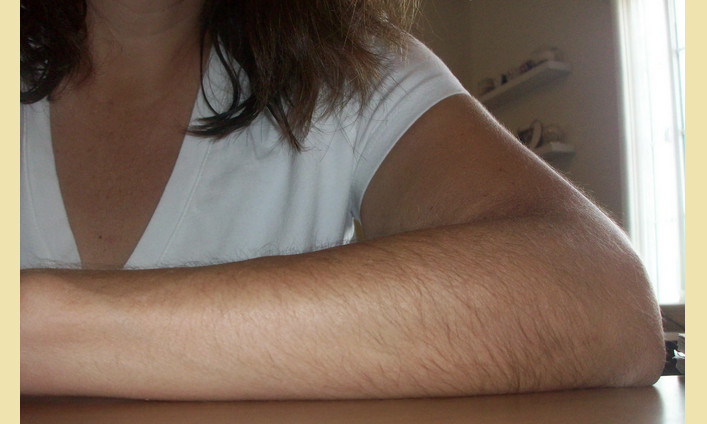 รูปถ่ายของผู้หญิงที่มีผมอยู่ในอ้อมแขนของเธอ