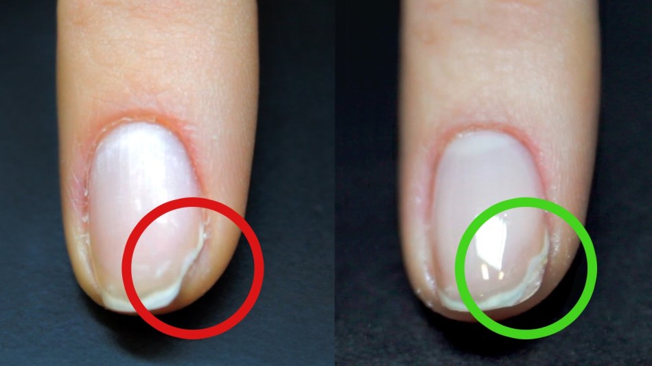 Réparation des ongles avec la base