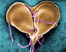 Što je Giardia? Kako se riješiti Lamblije?