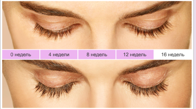 Careprost for eyelashes: photo before and after