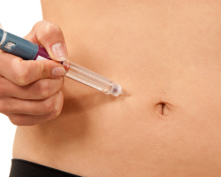 How to determine what type of diabetes mellitus without tests?