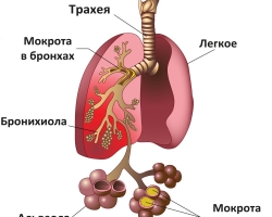 Pneumonia in adults, children, newborns: species, first signs, symptoms, causes, pathogens, ways of infection, complications, diagnosis, blood, sputum, x -ray, treatment, antibiotics, consequences, rehabilitation, and respiratory exercises. How much pneumonia is treated, how much to lie in the hospital?