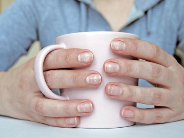 Белые пятна на ногтях пальцев рук: приметы. Гадание по белым пятнам на ногтях