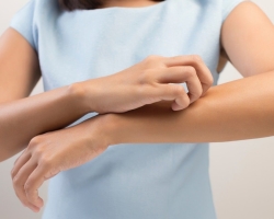 Why is it constantly itching in the same place on the leg, back, hand, stomach? Folk remedies and pharmacy drugs for the treatment of itching in the same place