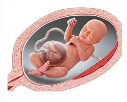 Le gastroshisis fœtal chez les nouveau-nés: causes, diagnostic et traitement