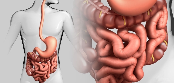 The relationship of sugar and intestinal cancer