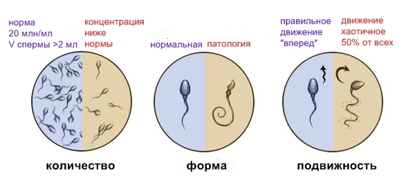 Спермограмма - норма, форма, подвижность