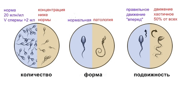 Spermogram - Norm, form, rörlighet