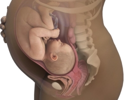 Dolgotrajna nosečnost: kaj je to, kakšno trajanje, razlike od prenosa