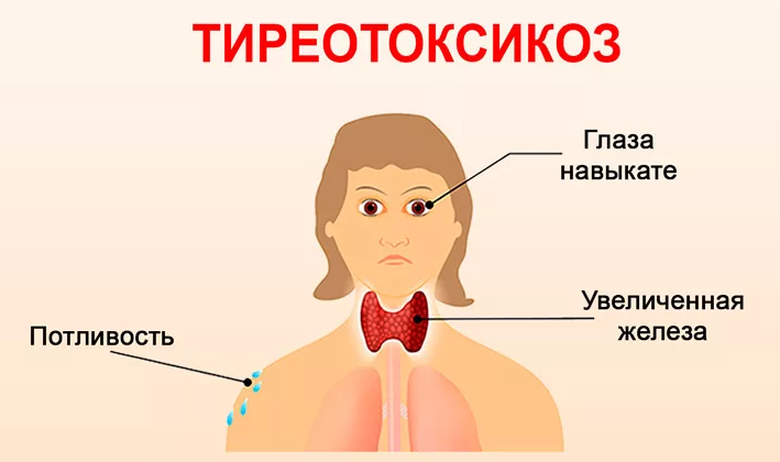 Thyroid diseases-the reason for the temperature increase 37.0-37.5