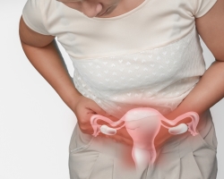 Opinion de l'utérus: causes, symptômes, comment traiter à la maison, sans chirurgie, revues. Lors de la prolongation de l'utérus, est-il possible de tomber enceinte?
