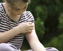 Des insectes d'insectes et de puces sur le corps d'un enfant, adulte: symptômes et traitement. À quoi ressemblent les piqûres, comment les distinguer des piqûres de moustiques?