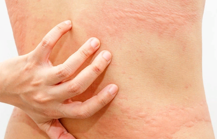 Красные пятна на теле: причины появления пятен на коже, методы лечения, диагностики и профилактики