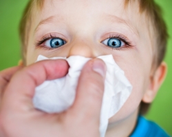 Shymite chez les enfants Symptômes et traitement. Phénomènes résiduels après sinusite. Comment traiter la sinusite chez les enfants à la maison?