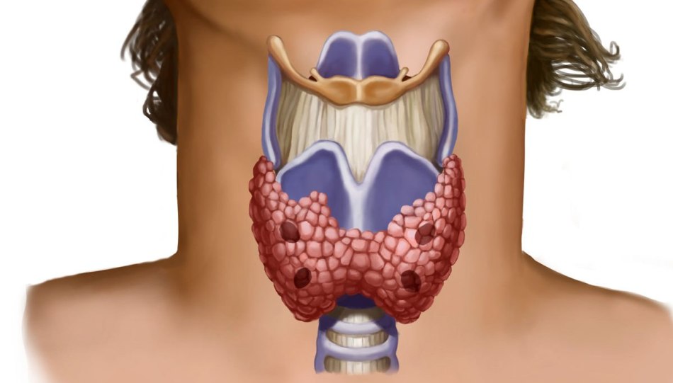 Colesterol și tiroidă: interconexiune