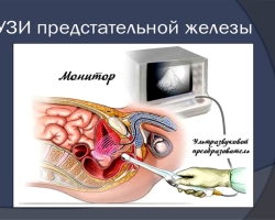 How to make an ultrasound of the prostate gland by transrectal and transabdominal methods, for what an ultrasound should be done, how to prepare it? In what cases does the doctor prescribe an ultrasound of the prostate gland? What results can be found by ultrasound of the prostate gland?