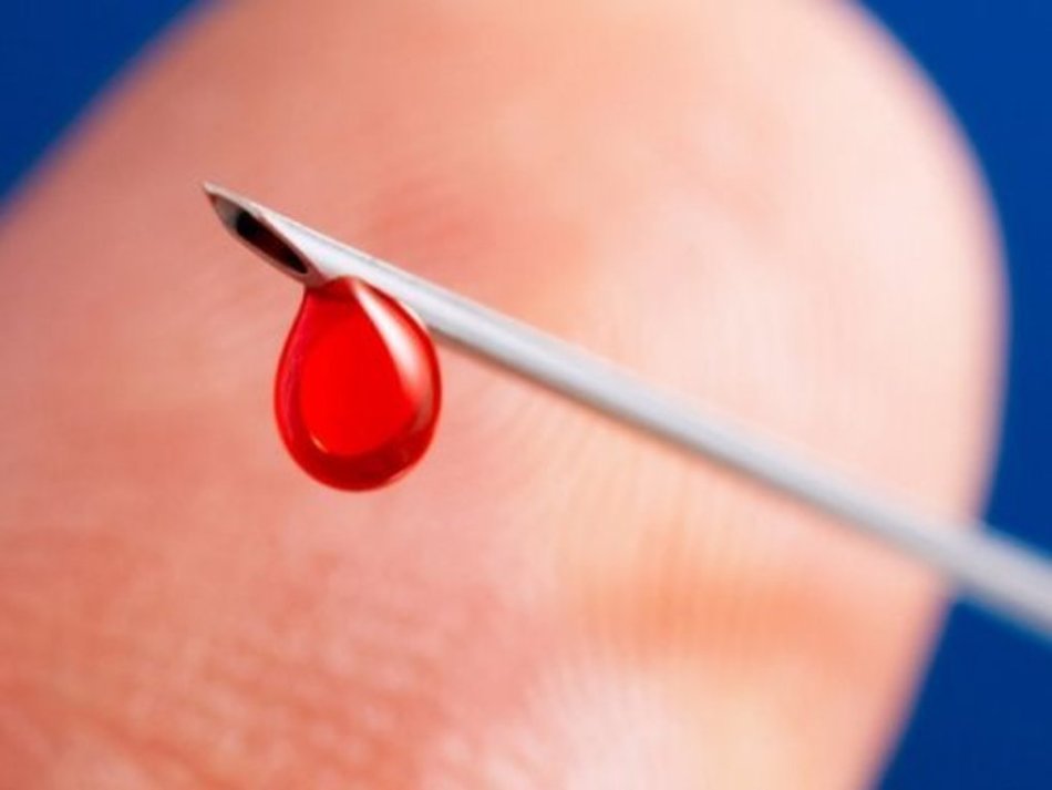 HIV se prenaša skozi krv