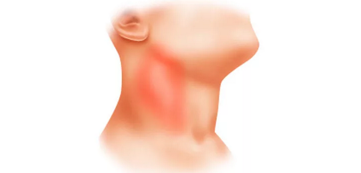 The lymph nodes on the neck and in the groin became inflamed