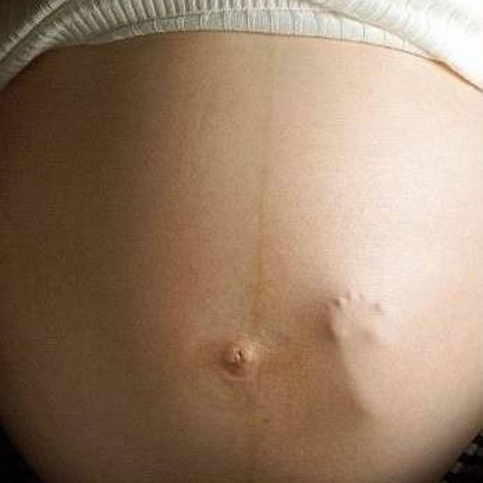 La jambe du bébé est visible à travers l'estomac de la mère