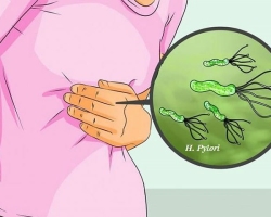 Baktérium Helicobacter pylori: A felfedezés, a megjelenés okai, a bőr tünetei és a testben, a fertőzés módszerei, a diagnózis, az antibiotikumokkal és a népi gyógyszerekkel történő kezelés, az étrend, a megelőzés. Mi fog történni, ha a helicobacteriosist nem kezelik?