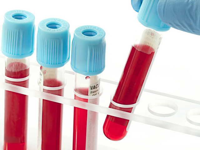 Krvno bele krvne celice: vrsta, norma. Povečana ali zmanjšana raven levkocitov v krvi: vzroki - kako se vrniti v normalno stanje?