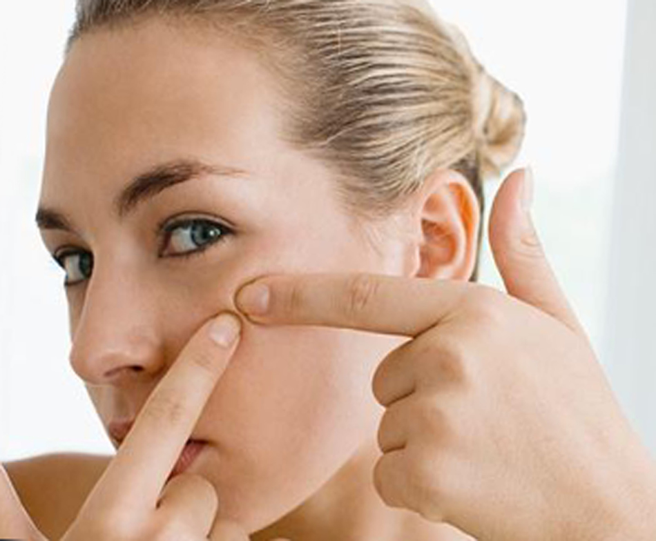 How to apply corvalol from acne?