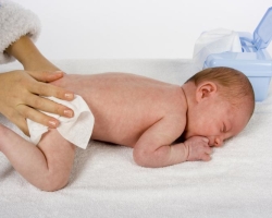 10 частых причин опрелости у новорожденных. Как избавиться от опрелостей?